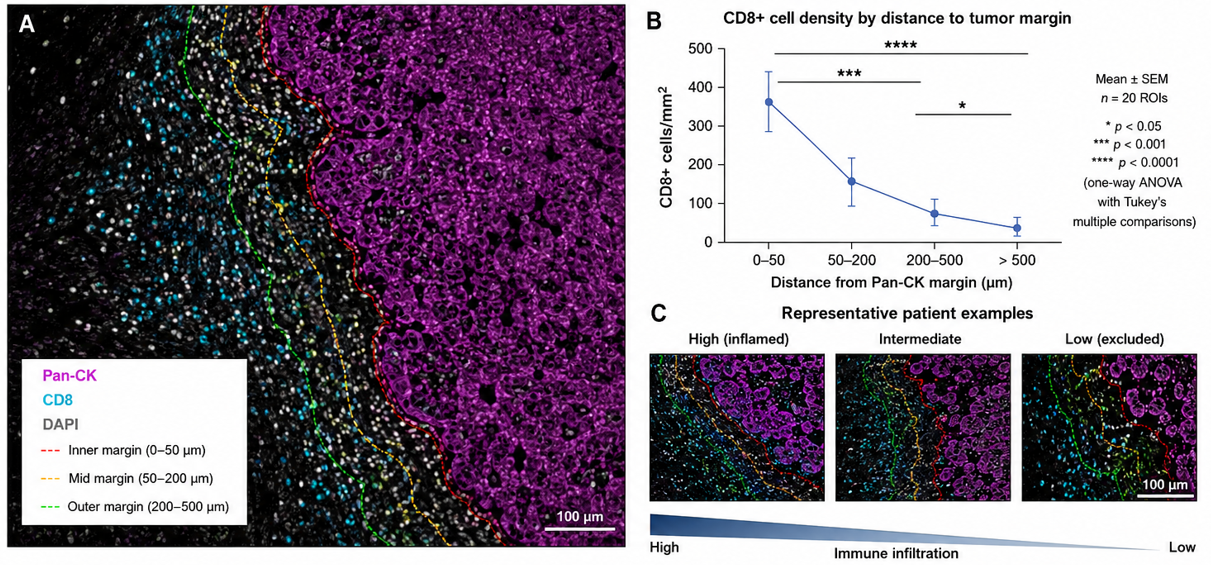 Multiplex immunofluorescence showing spatial distribution of CD8-positive T cells relative to Pan-CK-defined tumor margins, with density-by-distance graph and representative high, intermediate and low immune infiltration patterns.